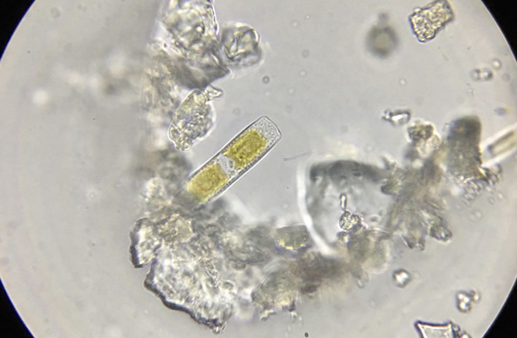 microscopic image of an alga diatom