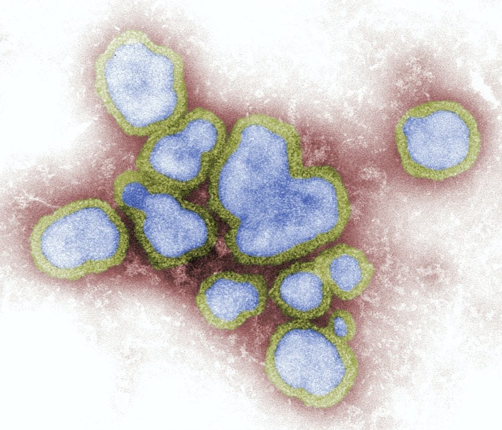 Influenza A virus that is colored blue and yellow with a red and white background