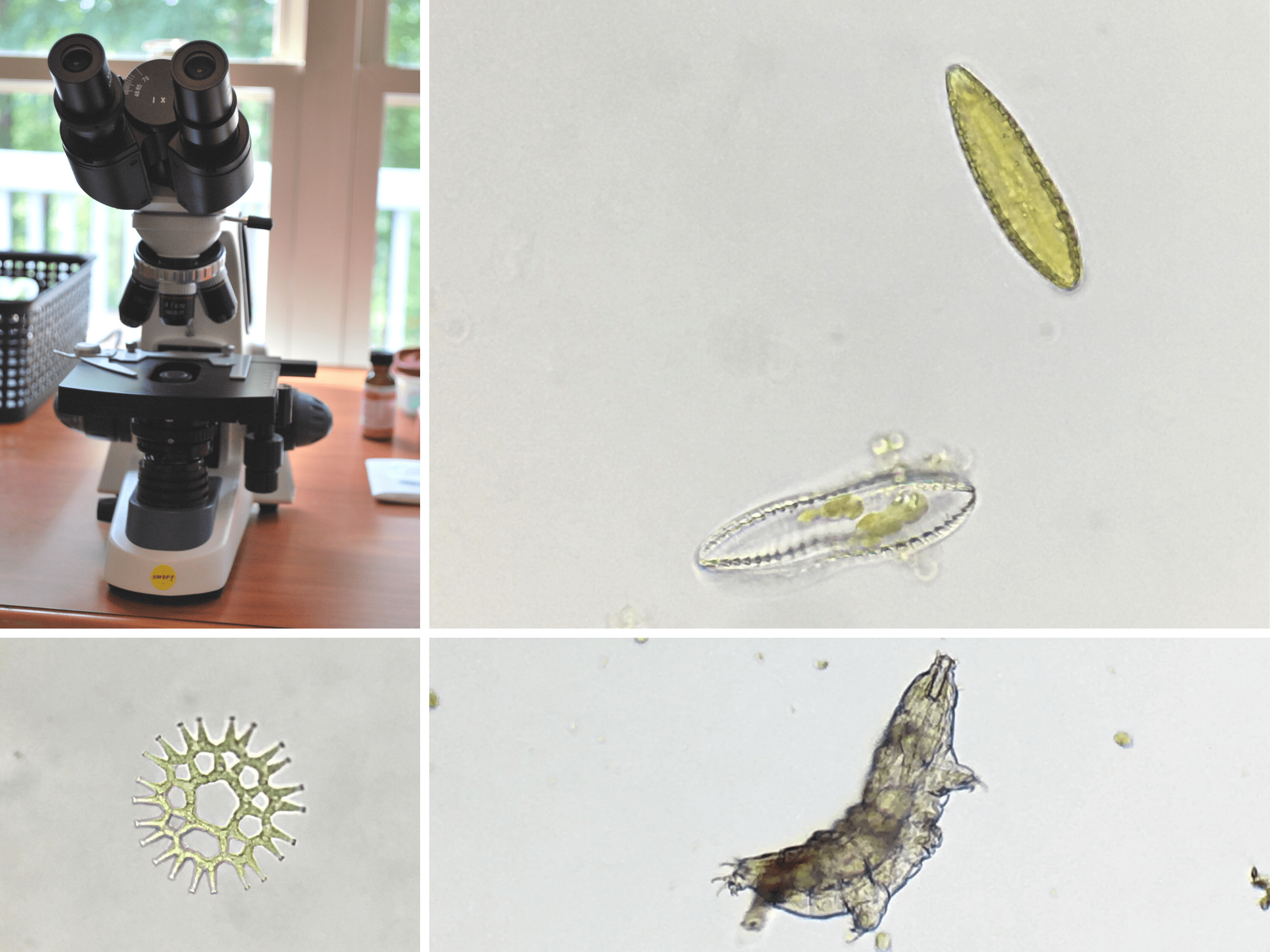 microorganisms in pond water under microscope
