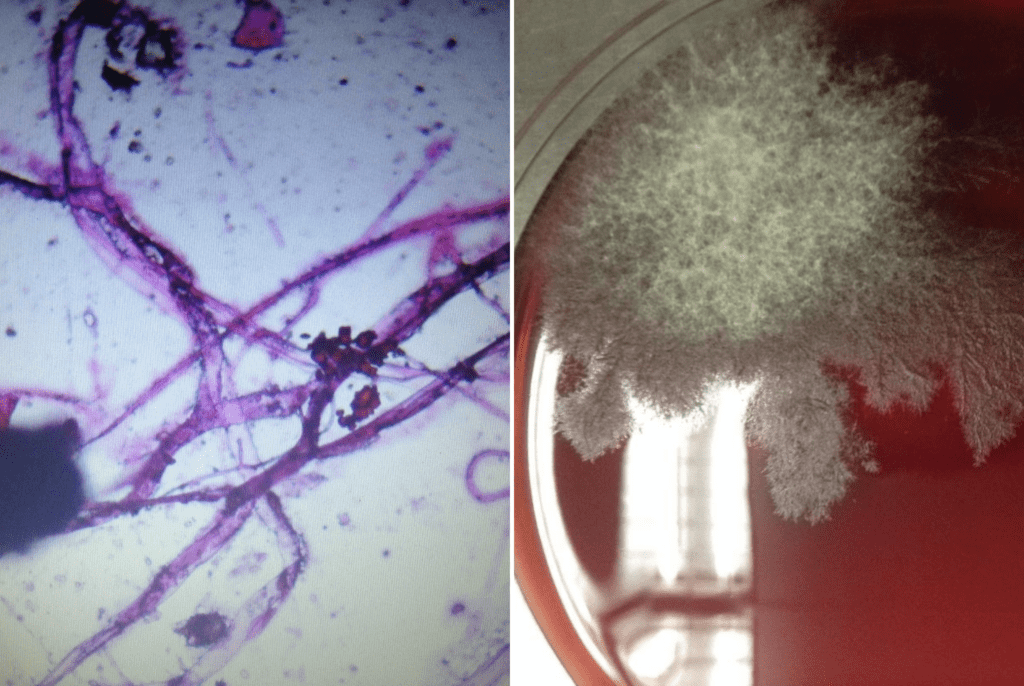 fungi-3-1024x686.png