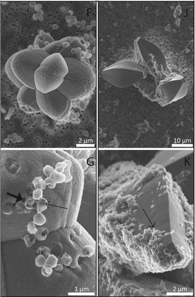 Transmission electron microscopy photos of archaea fossil extremophiles created in the lab. Grayscale.