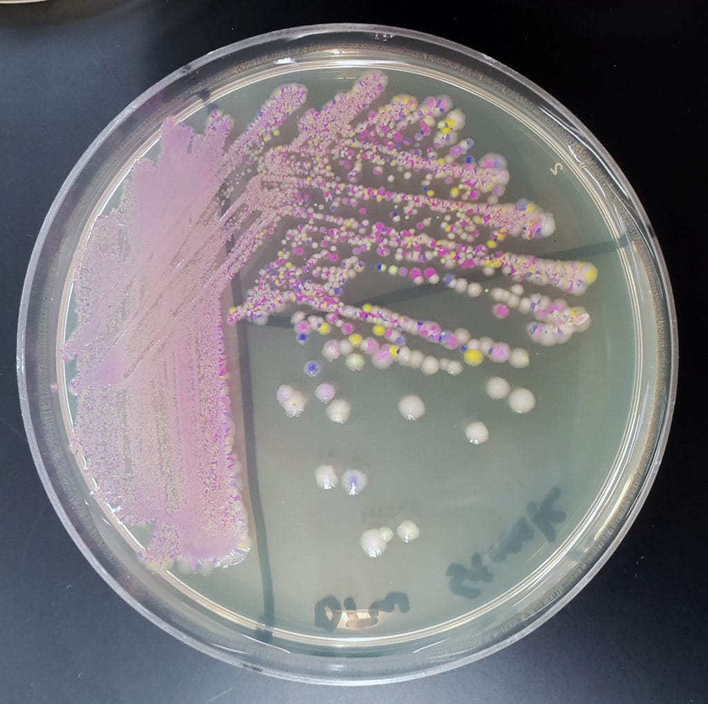 Bacteria struck out on a petri dish of various colors: pink, yellow, purple, and beige.