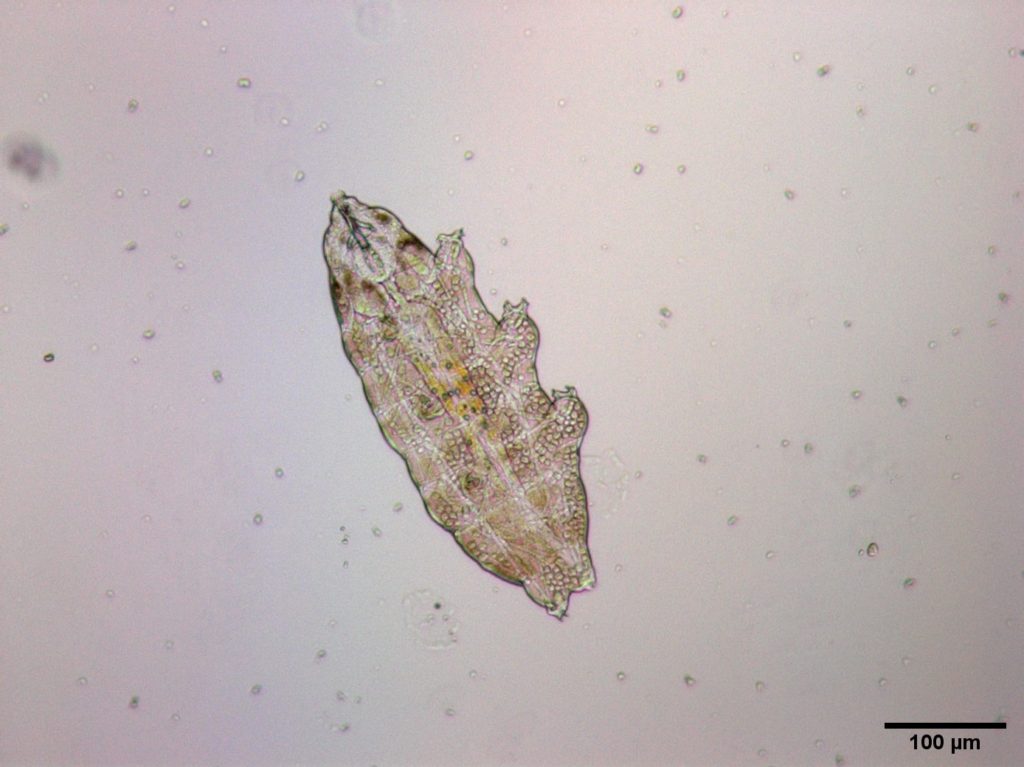 tardigrade under microscope