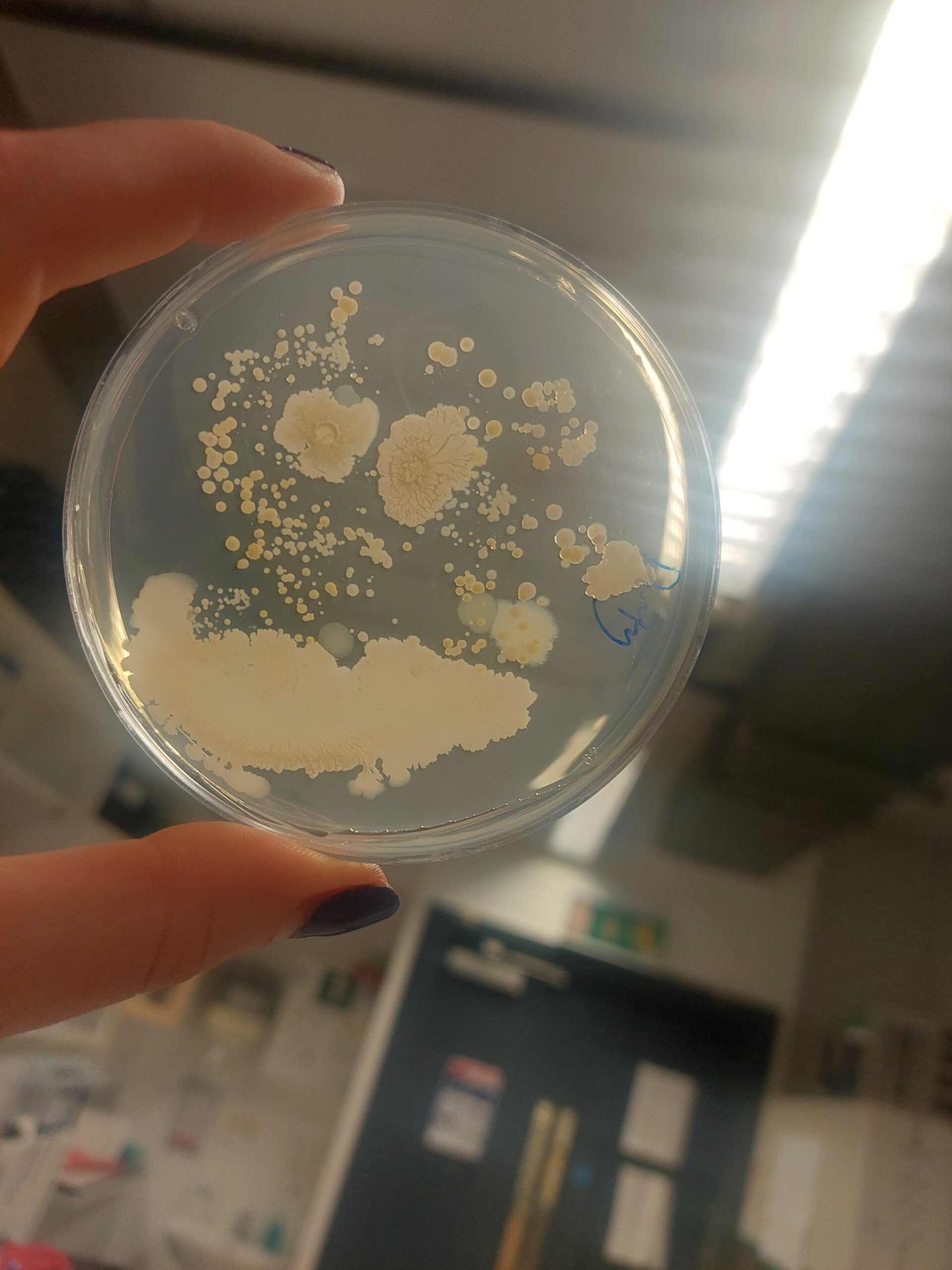 Petri dish showing lots of bacteria before hand washing.